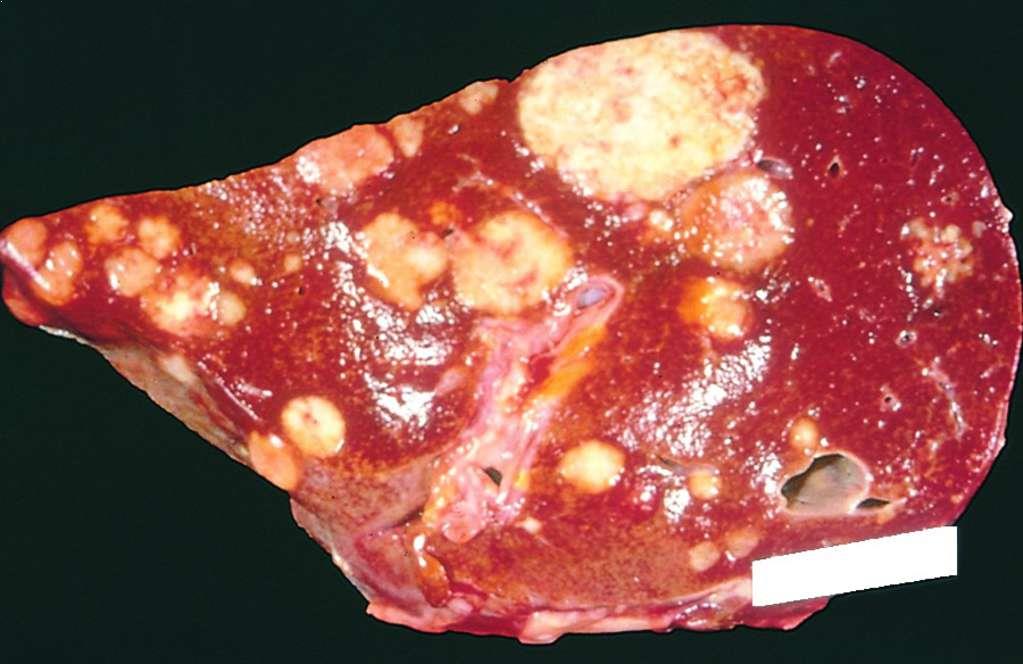 liver